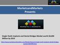 MarketsandMarkets Presents Single-Tooth Implants and Dental Bridges Market worth $4,690 Million by 2019