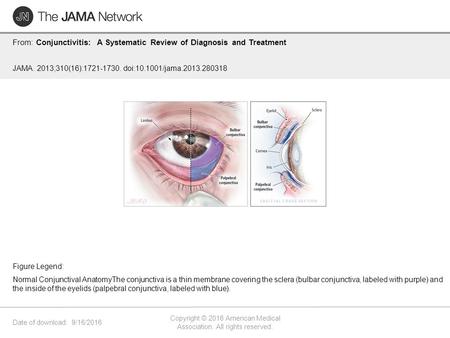 Date of download: 9/16/2016 Copyright © 2016 American Medical Association. All rights reserved. From: Conjunctivitis: A Systematic Review of Diagnosis.