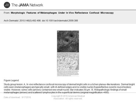 Date of download: 9/17/2016 Copyright © 2016 American Medical Association. All rights reserved. From: Morphologic Features of Melanophages Under In Vivo.