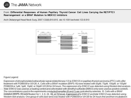 Date of download: 9/17/2016 Copyright © 2016 American Medical Association. All rights reserved. From: Differential Responses of Human Papillary Thyroid.