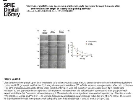 Date of download: 9/17/2016 Copyright © 2016 SPIE. All rights reserved. Oral keratinocyte migration upon laser irradiation. (a) Scratch wound assays in.