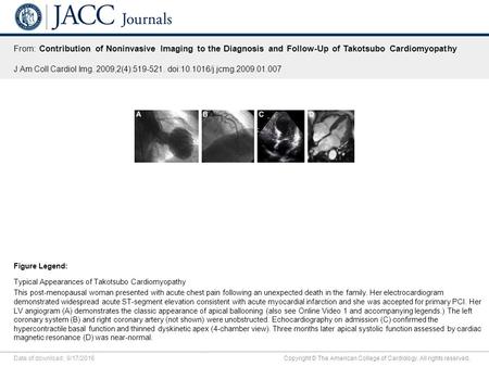 Date of download: 9/17/2016 Copyright © The American College of Cardiology. All rights reserved. From: Contribution of Noninvasive Imaging to the Diagnosis.