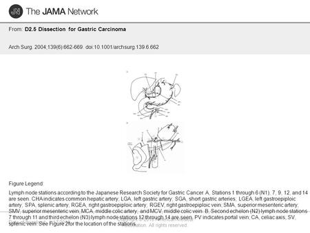 Date of download: 9/17/2016 Copyright © 2016 American Medical Association. All rights reserved. From: D2.5 Dissection for Gastric Carcinoma Arch Surg.