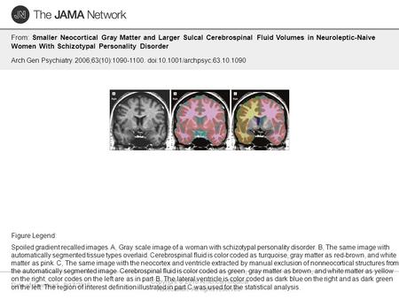 Date of download: 9/17/2016 Copyright © 2016 American Medical Association. All rights reserved. From: Smaller Neocortical Gray Matter and Larger Sulcal.