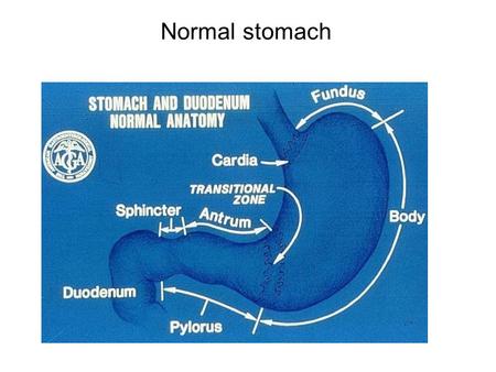 Normal stomach. Fundic mucosa with parietal & chief cells Antral mucosa with mucin secreting glands Stomach - Histology.