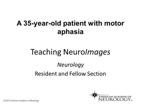 A 35-year-old patient with motor aphasia Teaching NeuroImages Neurology Resident and Fellow Section © 2013 American Academy of Neurology.