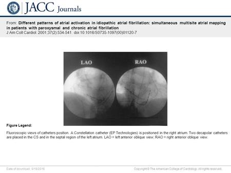 Date of download: 9/18/2016 Copyright © The American College of Cardiology. All rights reserved. From: Different patterns of atrial activation in idiopathic.