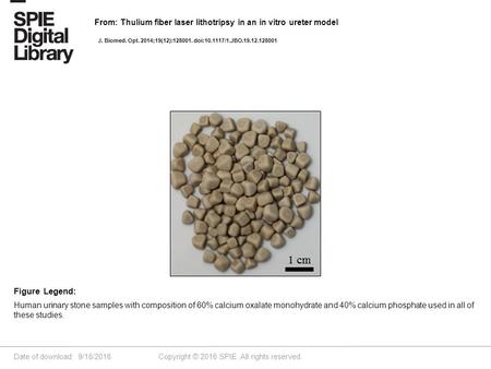 Date of download: 9/18/2016 Copyright © 2016 SPIE. All rights reserved. Human urinary stone samples with composition of 60% calcium oxalate monohydrate.