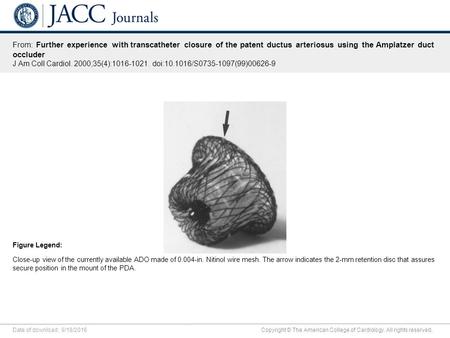 Date of download: 9/18/2016 Copyright © The American College of Cardiology. All rights reserved. From: Further experience with transcatheter closure of.