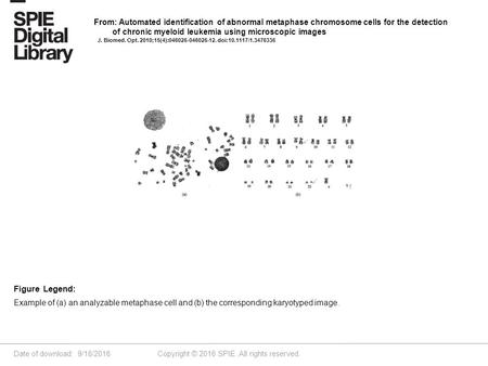 Date of download: 9/18/2016 Copyright © 2016 SPIE. All rights reserved. Example of (a) an analyzable metaphase cell and (b) the corresponding karyotyped.