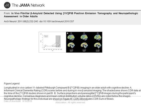 Date of download: 9/18/2016 Copyright © 2016 American Medical Association. All rights reserved. From: In Vivo Fibrillar β-Amyloid Detected Using [11C]PiB.