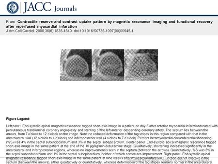 Date of download: 9/18/2016 Copyright © The American College of Cardiology. All rights reserved. From: Contractile reserve and contrast uptake pattern.