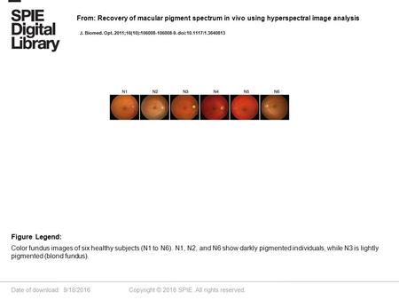 Date of download: 9/18/2016 Copyright © 2016 SPIE. All rights reserved. Color fundus images of six healthy subjects (N1 to N6). N1, N2, and N6 show darkly.