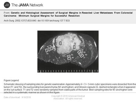 Date of download: 9/18/2016 Copyright © 2016 American Medical Association. All rights reserved. From: Genetic and Histological Assessment of Surgical Margins.