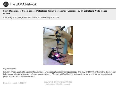 Date of download: 9/18/2016 Copyright © 2016 American Medical Association. All rights reserved. From: Detection of Colon Cancer Metastases With Fluorescence.