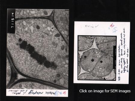 Click on image for SEM images. 10.2 electron microscope Principles and limitations of scanning and transmission EM Difference between magnification and.