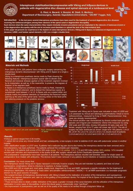 Introduction In the last years several interspinous prostheses have been used for the treatment of several degenerative disc diseases involving the lumbosacralregion;