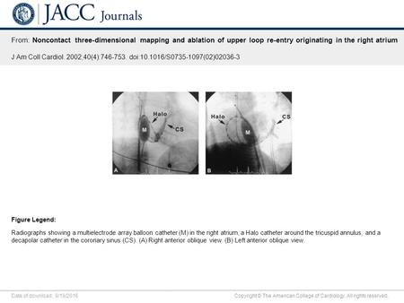 Date of download: 9/19/2016 Copyright © The American College of Cardiology. All rights reserved. From: Noncontact three-dimensional mapping and ablation.