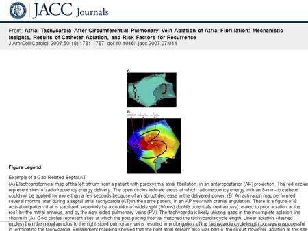 Date of download: 9/19/2016 Copyright © The American College of Cardiology. All rights reserved. From: Atrial Tachycardia After Circumferential Pulmonary.