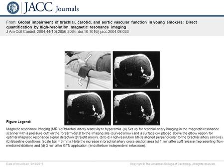 Date of download: 9/19/2016 Copyright © The American College of Cardiology. All rights reserved. From: Global impairment of brachial, carotid, and aortic.