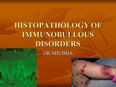 HISTOPATHOLOGY OF IMMUNOBULLOUS DISORDERS DR.SHUBHA.