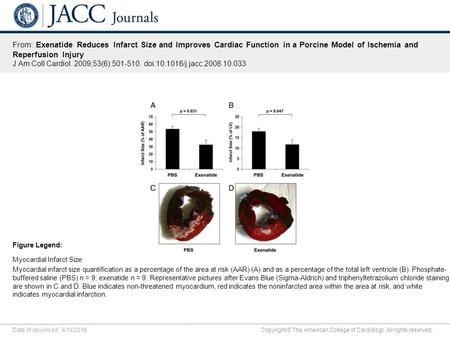 Date of download: 9/19/2016 Copyright © The American College of Cardiology. All rights reserved. From: Exenatide Reduces Infarct Size and Improves Cardiac.