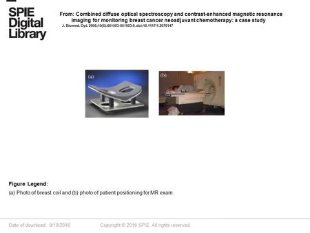 Date of download: 9/19/2016 Copyright © 2016 SPIE. All rights reserved. (a) Photo of breast coil and (b) photo of patient positioning for MR exam. Figure.