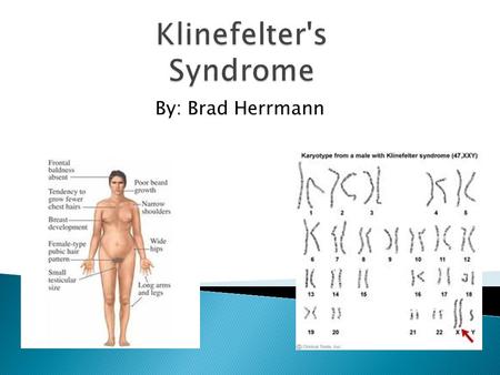 By: Brad Herrmann.  There are no other names because Dr. Harry Klinefelter found the problem in 1942 and is named named after him for his find.