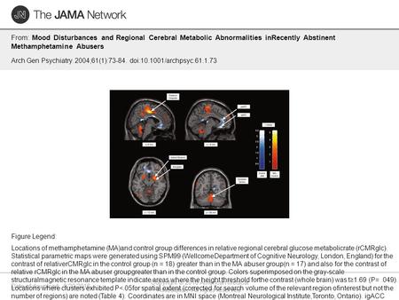 Date of download: 9/20/2016 Copyright © 2016 American Medical Association. All rights reserved. From: Mood Disturbances and Regional Cerebral Metabolic.