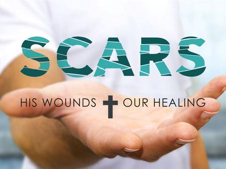 Sin, Scars, and Healing 1 Timothy 1:12-16.