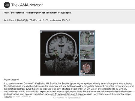 Date of download: 9/20/2016 Copyright © 2016 American Medical Association. All rights reserved. From: Stereotactic Radiosurgery for Treatment of Epilepsy.