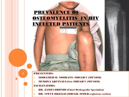 PREVALENCE OF OSTEOMYELITIS IN HIV INFECTED PATIENTS. PRESENTERS: 1. MOHAMED M. NOORANY- MBChB V (MUSOM) 2. MUKOYA AQUINATA (Sr)- MBChB V (MUSOM) FACILITATORS: