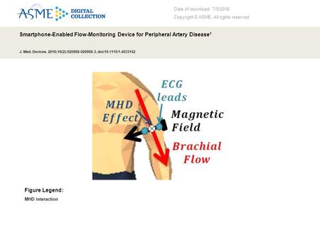 Date of download: 7/5/2016 Copyright © ASME. All rights reserved. Smartphone-Enabled Flow-Monitoring Device for Peripheral Artery Disease 1 J. Med. Devices.