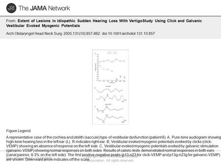 Date of download: 11/12/2016 Copyright © 2016 American Medical Association. All rights reserved. From: Extent of Lesions in Idiopathic Sudden Hearing Loss.