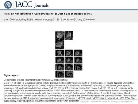 Date of download: 11/12/2016 Copyright © The American College of Cardiology. All rights reserved. From: LV Noncompaction Cardiomyopathy or Just a Lot of.