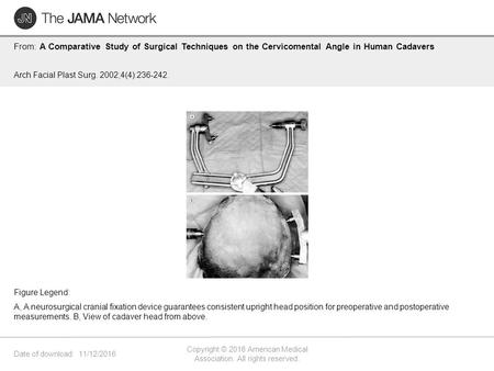 Date of download: 11/12/2016 Copyright © 2016 American Medical Association. All rights reserved. From: A Comparative Study of Surgical Techniques on the.