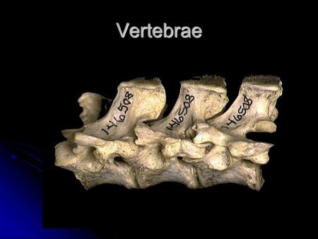 Vertebrae. Textbook Page Spinous Process 1. Spinous Process 2. Articular Facet 2. Articular Facet 3. Transverse Process 3. Transverse Process 4.