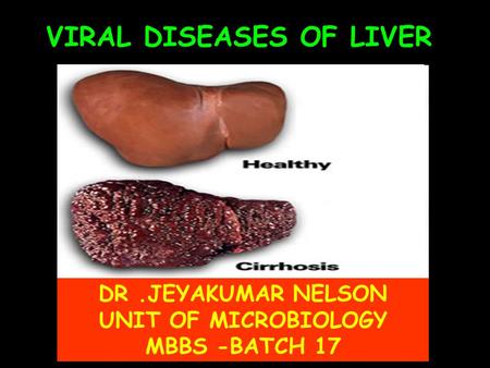 VIRAL DISEASES OF LIVER DR.JEYAKUMAR NELSON UNIT OF MICROBIOLOGY MBBS -BATCH 17.