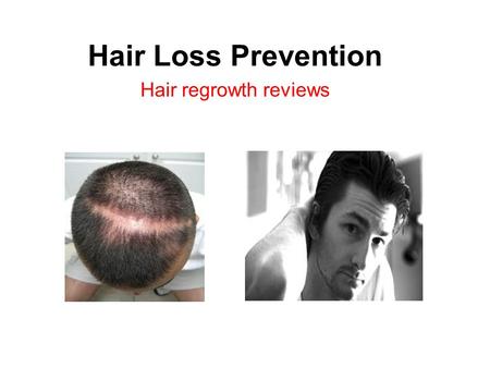 Hair Loss Prevention Hair regrowth reviews. Hair Loss 101 and Hair Growth Treatment for Men According to the British National Health Service, the most.