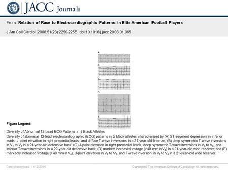 Date of download: 11/12/2016 Copyright © The American College of Cardiology. All rights reserved. From: Relation of Race to Electrocardiographic Patterns.