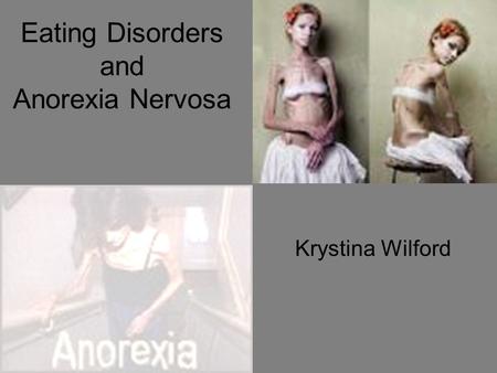 Eating Disorders and Anorexia Nervosa Krystina Wilford.