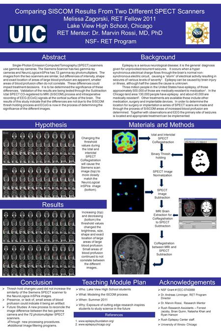 Changing the threshold values during the Ictal and interictal SPECT CoRegistration will cause the Siemens scan image (top) to more closely match the NeuroLogical.