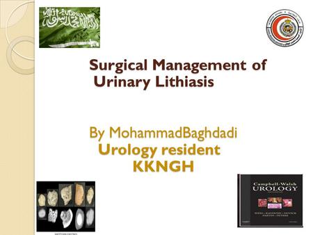 Kidney Stones. Surgical Management of Urinary Lithiasis By MohammadBaghdadi Urology resident KKNGH.