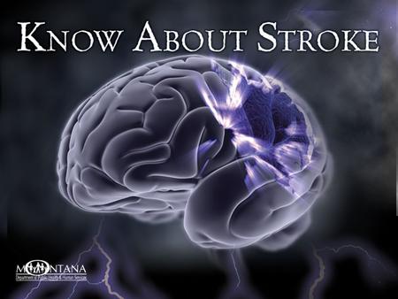 What you need to know about stroke.