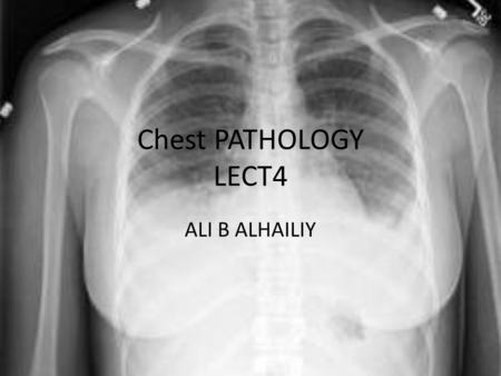 Chest PATHOLOGY LECT4 ALI B ALHAILIY. CHEST ANATOMY.