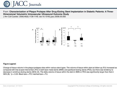 From: Characterization of Plaque Prolapse After Drug-Eluting Stent Implantation in Diabetic Patients: A Three-Dimensional Volumetric Intravascular Ultrasound.