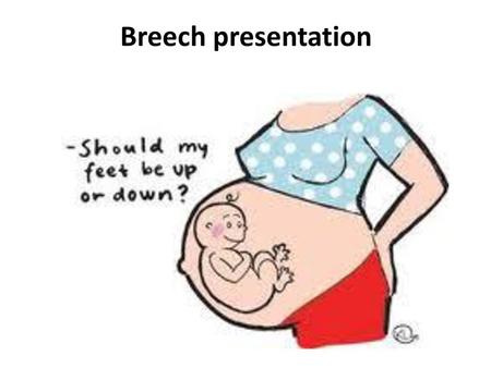 Breech presentation.