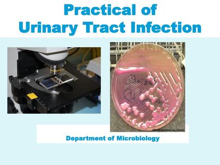 Urinary Tract Infection Department of Microbiology