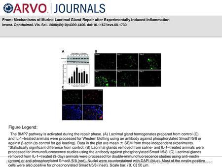 Invest. Ophthalmol. Vis. Sci ;49(10): doi: /iovs Figure Legend: