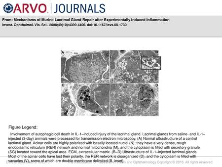 Invest. Ophthalmol. Vis. Sci ;49(10): doi: /iovs Figure Legend: